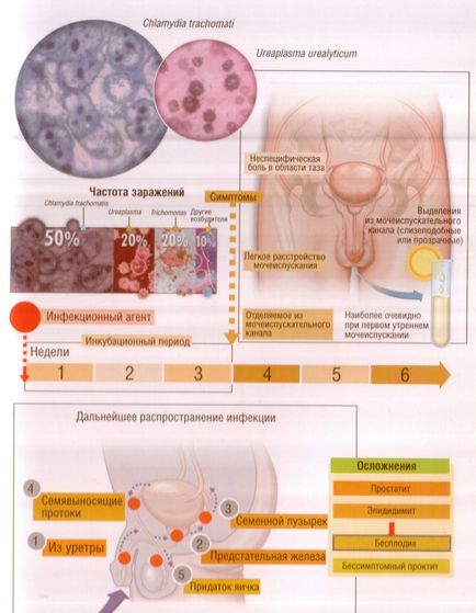 Toate ureaplasmosis tratament