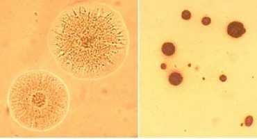 Toate ureaplasmosis tratament