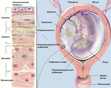 Toate ureaplasmosis tratament