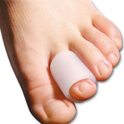 Ce se poate face cu unghiile de la picioare