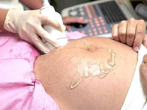 3D cu ultrasunete în timpul sarcinii, care poate fi văzut și în ce condiții este mai bine să efectueze un sondaj