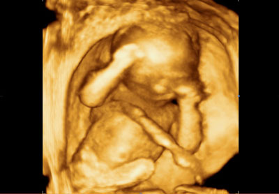 ecografie 4D în timpul sarcinii