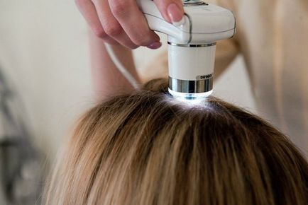 6 Cele mai frecvente boli părului și pielii capului (boli ale părului) 6 Cele mai frecvente boli ale scalpului și a părului