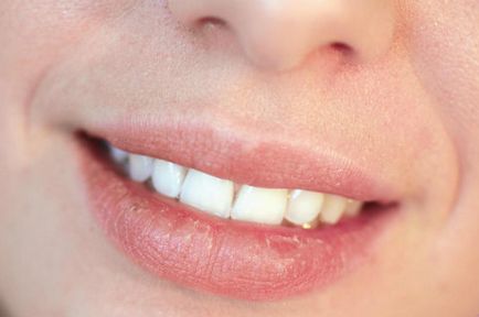 buzele albe raid motivul pentru revista on-line pentru femei