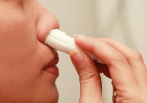 Cauzele frecvente sângerări nazale, tratament și primul ajutor pentru epistaxis (nas) Cauzele frecvente, sângerări nazale de tratament și de prim ajutor pentru epistaxis
