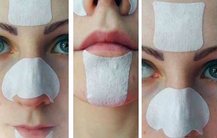 Tratamentul Blackheads și îndepărtarea Comedoanele deschise pe față și nasul unui copil