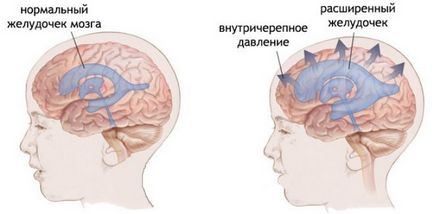 Ce se poate face în cazul în care copilul are 5, dureri de cap de tratament de 6, 7, 10 ani de dureri de cap la copii