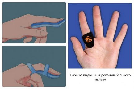 Ce să faci când degetele faceți clic pe tratament video și de prevenire exerciții pentru degete