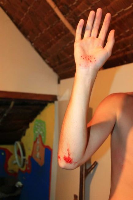 Ce se poate face într-un accident pe o motoretă! Experiența noastră abisal (deplorabilă) Ce se poate face într-un accident pe o motoretă! Experiența noastră abisal