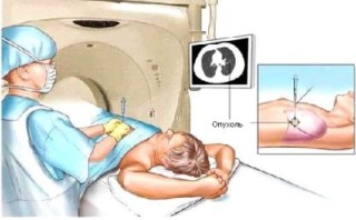 Ce scanare CT a plămânilor și bronhiilor