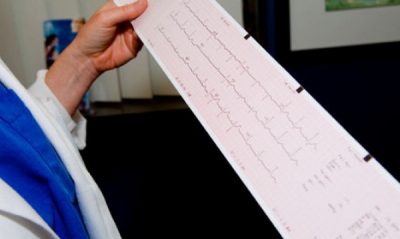 Electrocardiograma în medicină (ECG), care este