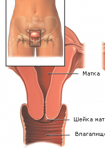 Fotografii de eroziune de col uterin (18 poze)