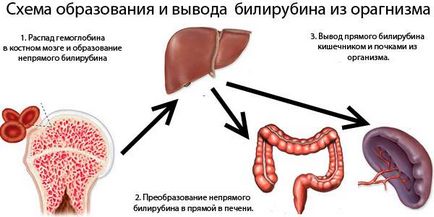 hiperbilirubinemie benign, cauze neonatale, tratament