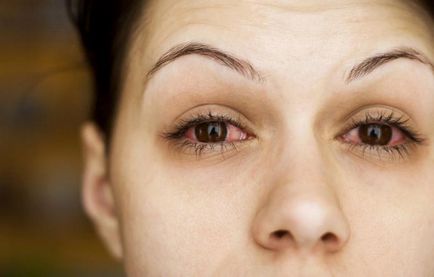 simptome de infectare cu ochi