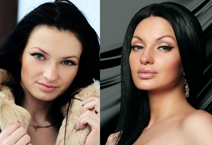 După cum a variat Evgeny Gusev (Feofilaktova) înainte și după rinoplastie și mamoplastie - 300