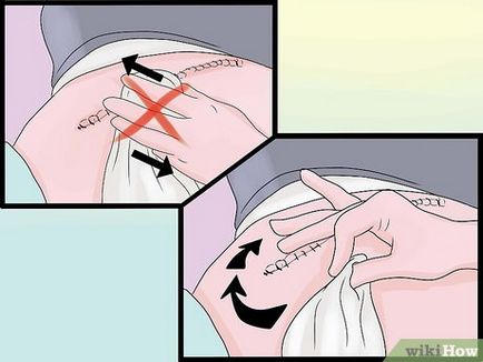 Cum să luați un duș după o intervenție chirurgicală