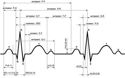 Cum de a recunoaște un infarct miocardic pe ECG - performanta decodare