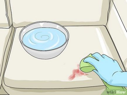 Cum de a elimina uscate pete de sânge de pe canapea