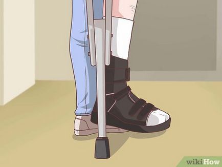 Cum de a recupera de la o intervenție chirurgicală pe piciorul