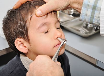 Sânge din nas din 10 motive copilului