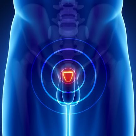 Tratamentul adenom de remedii populare la domiciliu