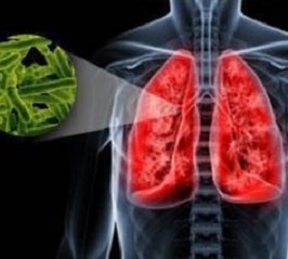Tratamentul fibrozei pulmonare