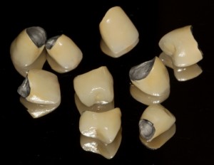 Metalo-ceramice sau zirconiu coroane pe un dinte care alege