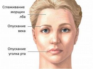 simptome nervoase facial nevralgii si tratament