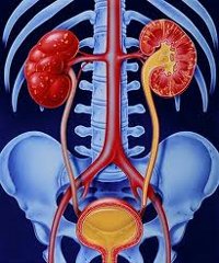 Pielonefrita acuta - cauze, simptome, diagnostic și tratament