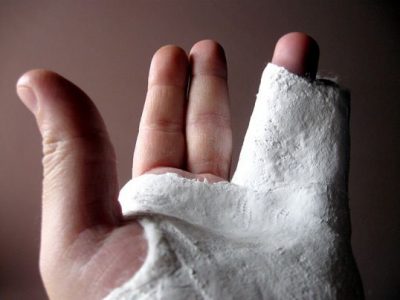 Fractura degetul mic, degetul mare asupra simptomelor de mână și tratament, cum să identifice