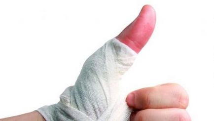 Fractura degetul mic, degetul mare asupra simptomelor de mână și tratament, cum să identifice