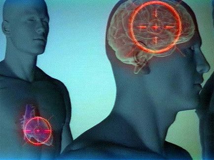 Primele semne de atac și de accident vascular cerebral simptome cardiace și precursori pentru femei și bărbați