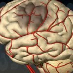 Primele semne si simptome de accident vascular cerebral si atac de cord la femei tratament de prim ajutor