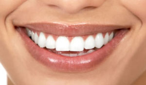 proteze dentare din plastic pro și contra de dinți din plastic, comentarii, pret