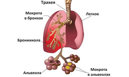 Pregătirile pentru lichefierea sputei în special tratamentul tusei