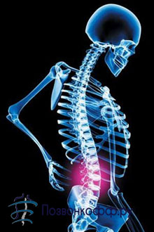 Motivele pentru apariția și dezvoltarea herniei vertebrale