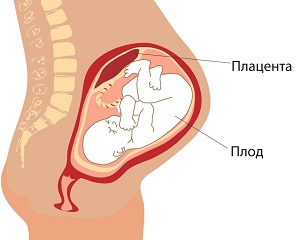 Amplasarea placentă în timpul sarcinii - opțiuni de normă
