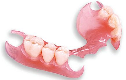 Silicon protezelor dentare pro și contra