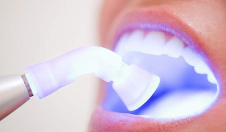 Cât costă o curatare dentara la dentist