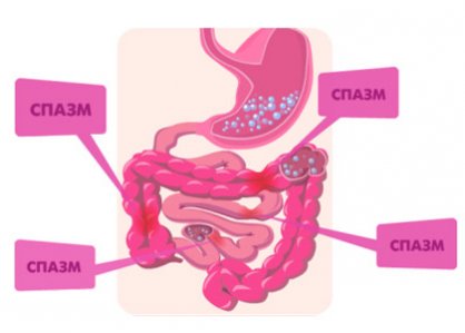 Spasmele cauzele intestinului și tratamentul
