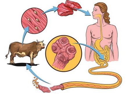 Teniarinhoza simptome principale cu caracteristici de prevenire și tratament