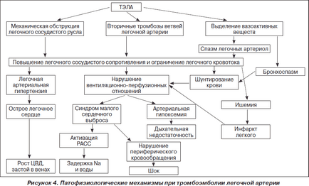 Pulmonare diagnostic si tratament embolism algoritmi, portal de radiologi