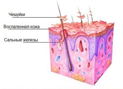 Restaurarea parului la domiciliu cum se face rapid