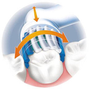 Periuta de dinti electrica, cu ultrasunete sau acustic