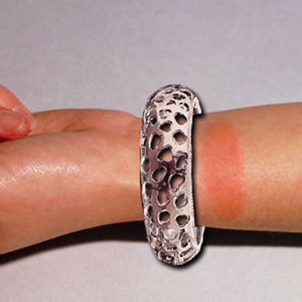Alergic la argint - simptome de reacție se manifestă, motivele care fac