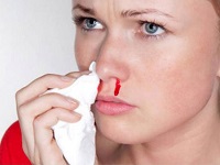 Adesea, există sângerare din nas - cauze pentru adulți