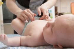 Nou-născutul proces buricului (neonate) Nou-născutul proces buric