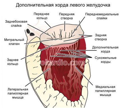 coardă suplimentară a ventriculului stâng cauze, tipuri, simptome și tratament