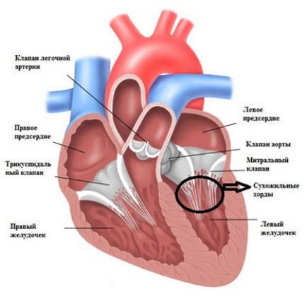 coardă suplimentară în inima unui copil dhlzh, coardă în plus, coarda ventriculului stâng al inimii