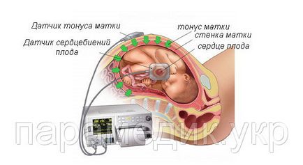 Doppler fetal - acesta este modul în care să folosească în mod corespunzător